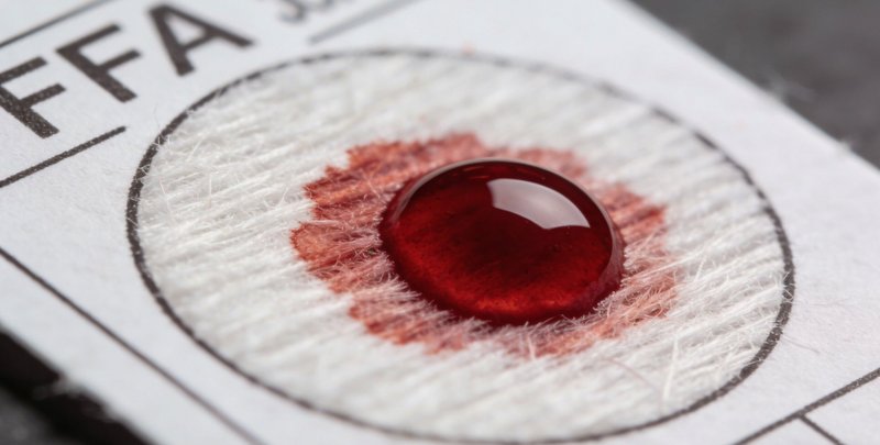 护士正在进行规范的血液样本采集