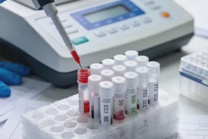 胃镜医生正在对胃部病灶进行活检操作