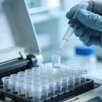 肾小球基底膜电镜下的分层改变示意图