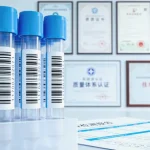 护士轻柔地为水肿婴儿测量腿围