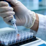 指甲-髌骨综合征典型指甲与膝盖X光示意图