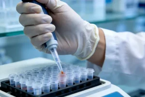 指甲-髌骨综合征典型指甲与膝盖X光示意图