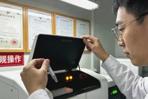 瓦登伯革氏综合征患儿面部特征示意图