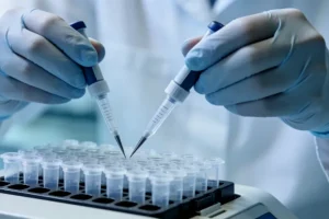 CHARGE综合征典型面部特征示意图