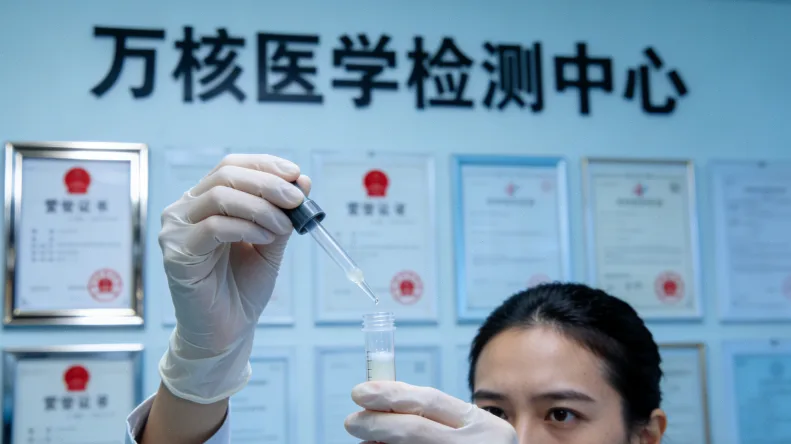 德朗热综合征患儿特征性面容示意图