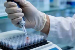 产前超声显示胎儿后脑膜膨出示意图