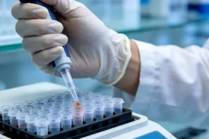 乔布综合征患者典型面部特征与湿疹示意图