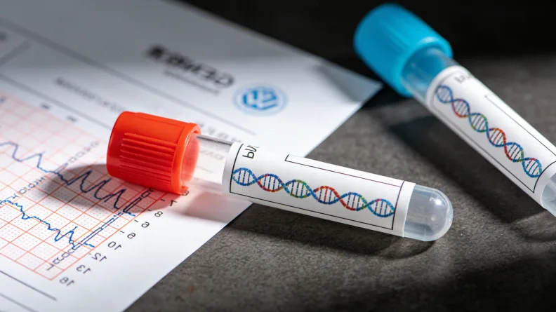 普通奶粉与深度水解奶粉蛋白质结构对比图解