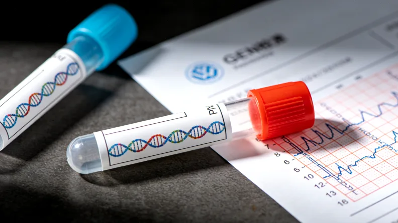 放大镜聚焦在服务合同的细则条款上