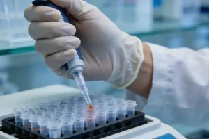 肺癌脑转移MRI影像示意图