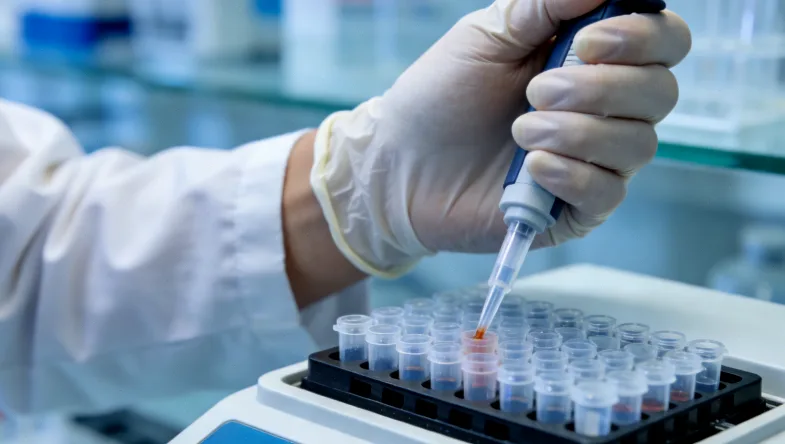 肺癌组织活检在CT引导下进行