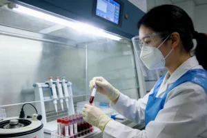 肝癌手术前后AFP变化趋势图