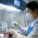 AFP血清浓度随时间变化曲线图