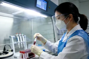 AFP血清浓度随时间变化曲线图