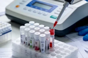 病理科医生在显微镜下观察乳腺癌组织切片